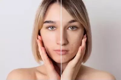 Harmonizacao-Facial-em-Sao-Vicente-SP