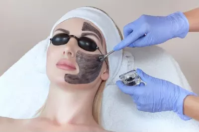 black-Peel-em-são-vicente-sp