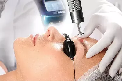 remoção-de-micropgmentação-de-sobrancelha